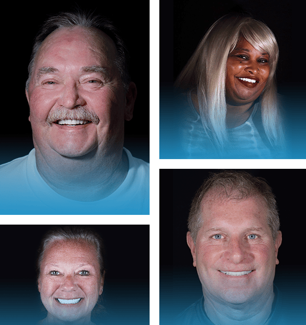 Snap On Dentures Cost in Mexico At 4000 USD Per Arch