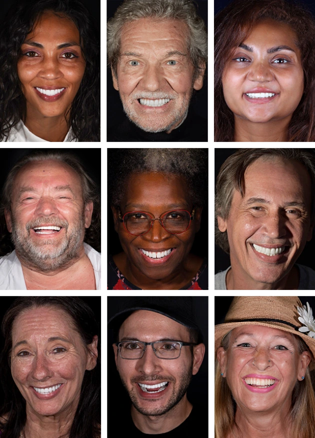 all on 4 dental implants mexico reviews