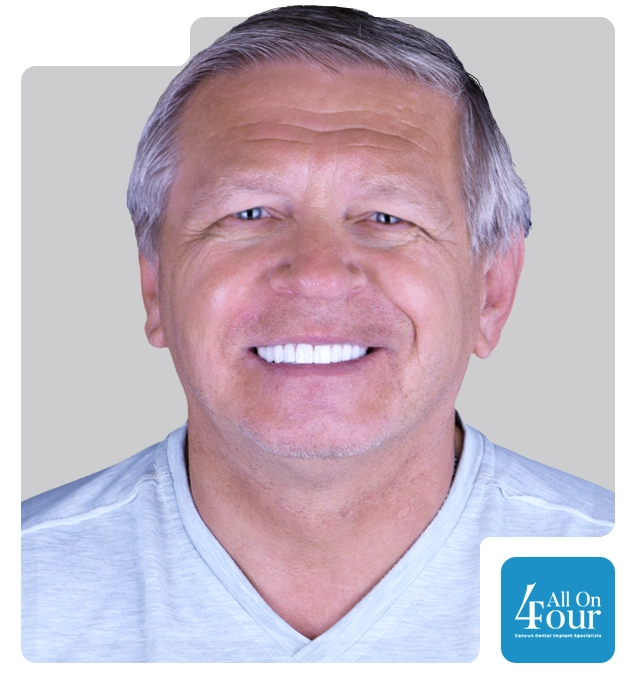 All on 4 dental implants Cancun Mexico Real Patients