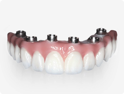 All on 4 with Crystal Ultra™ Hybrid