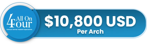 All on 4 dental implant cost mexico - Per Arch