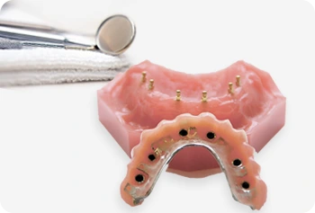 Ball abutment overdenture