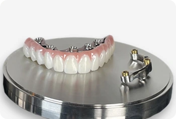 Bar Retained Overdenture