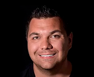 Snap on dentures in Cancun real patient 7