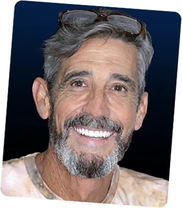 Rated best dentist in Cancun Mexico real patient 2